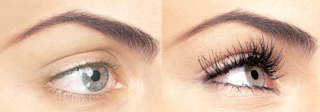 Photo Gallery Before/After THE FUTURE OF EYELASH ENHANCEMENT