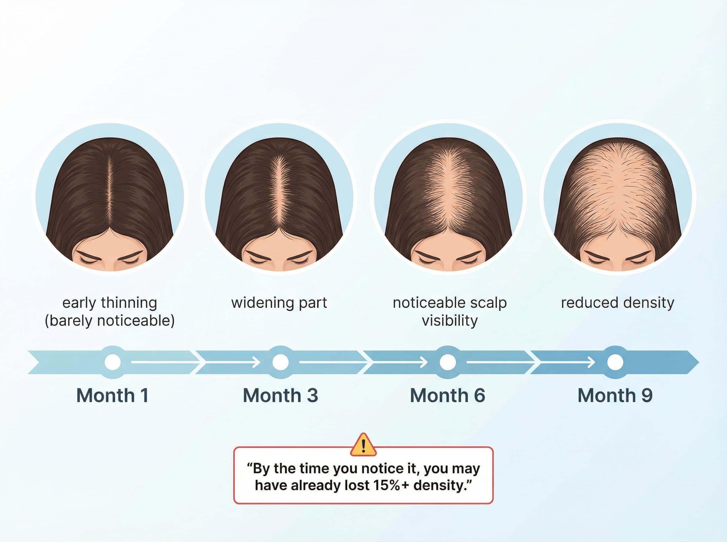 Why DIY Hair Loss Remedies Fail Women in London & Essex