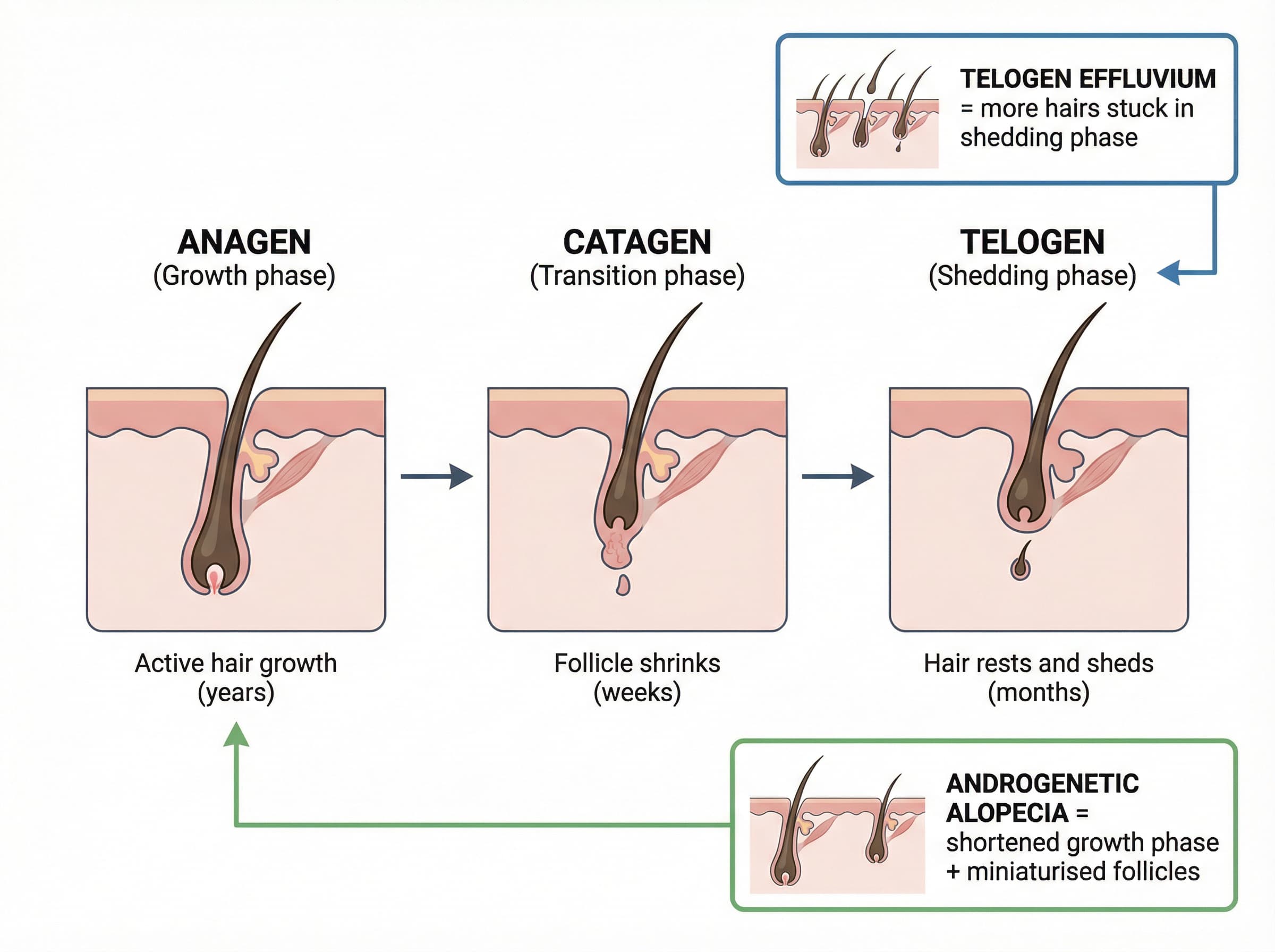 Why DIY Hair Loss Remedies Fail Women in London & Essex
