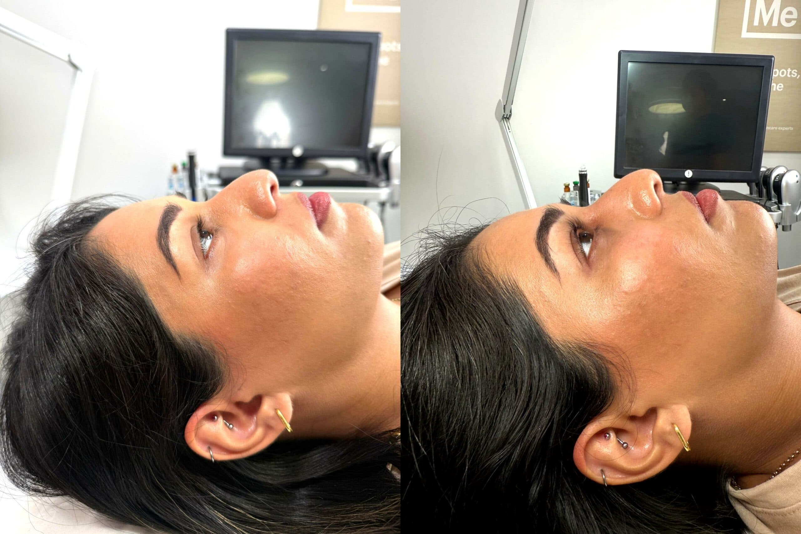 Before and after Lash Lift showing natural lash curl and lifted results