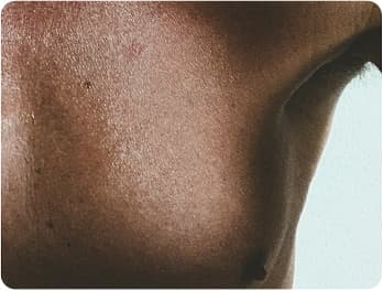 Male Breast