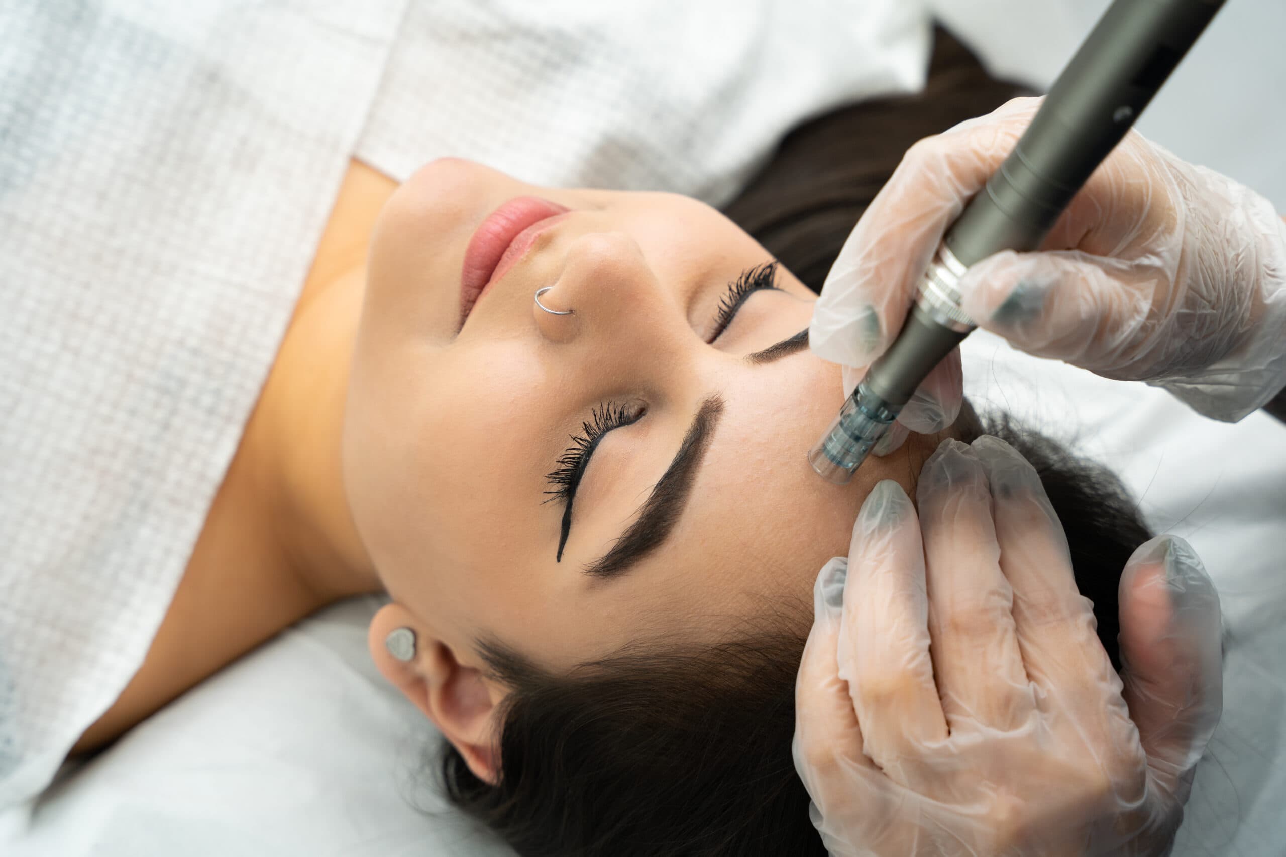 We Tracked Six Months of Vampire Facial Results