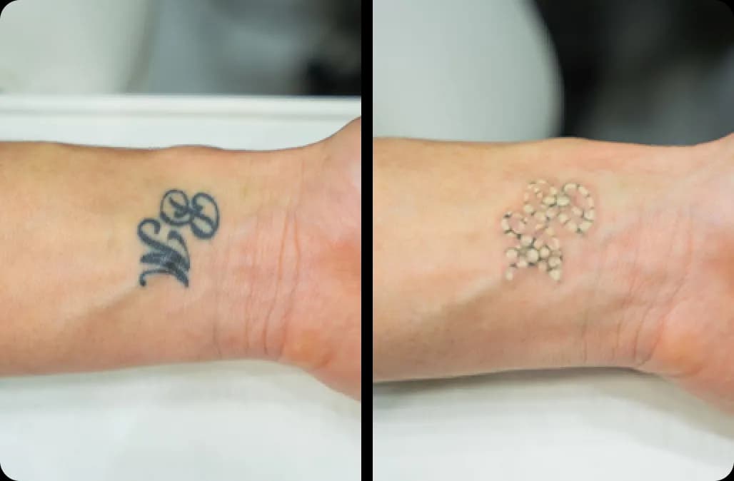 tatto ba3