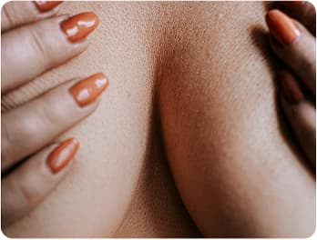 Breast Lift