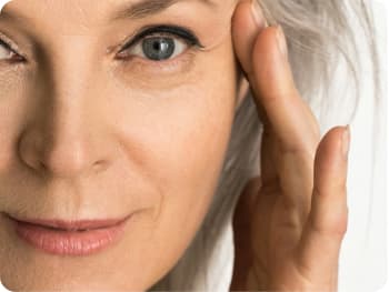 Dermal Fillers
