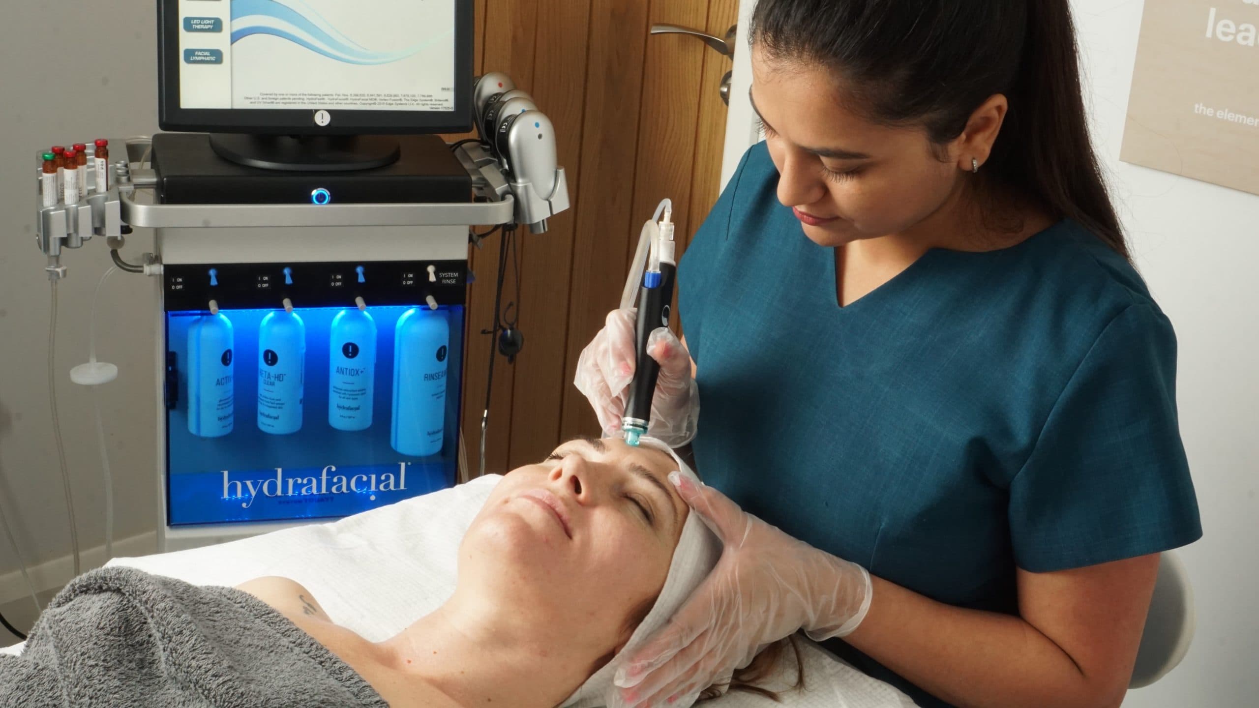 The Full Guide to Microneedling in Ilford