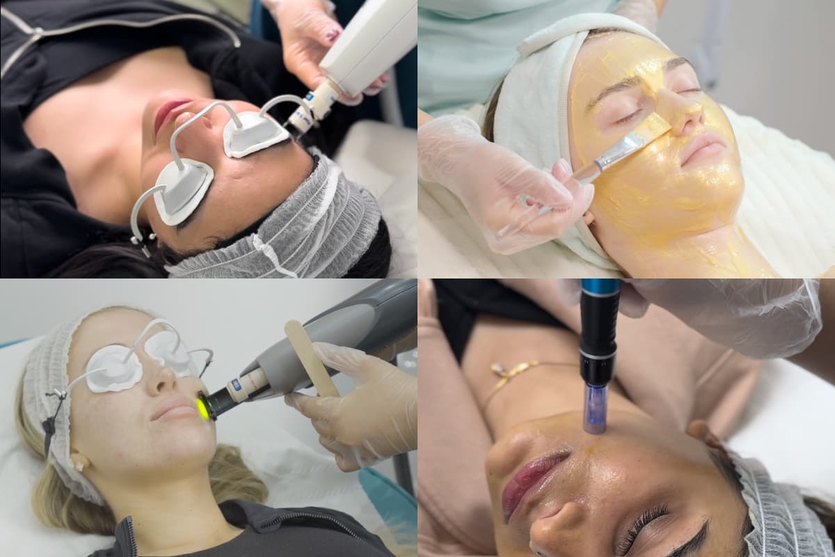 Why Professional Hyperpigmentation Treatment Actually Works