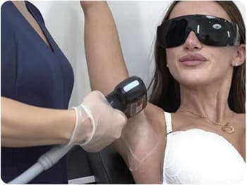 Laser Hair Removal
