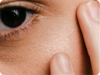Mesotherapy