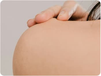 PCOS Hair Removal
