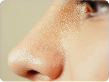 Rhinoplasty Septoplasty 1