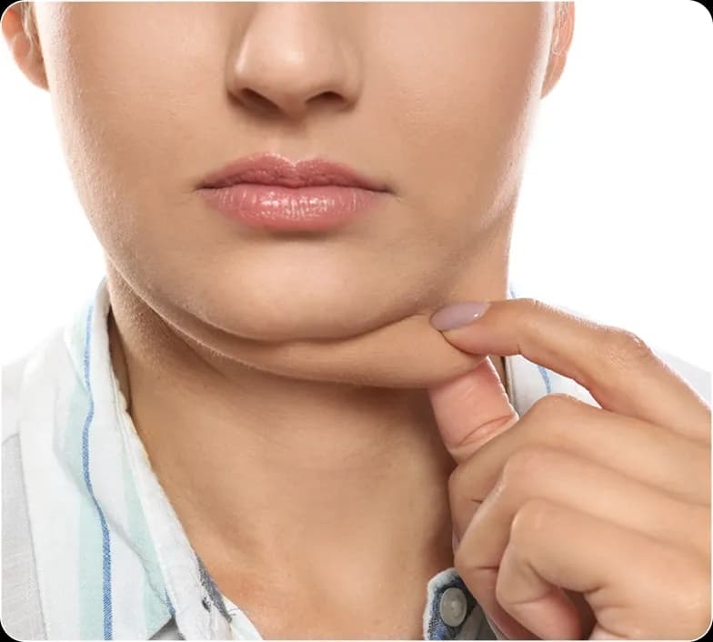 double chin banner