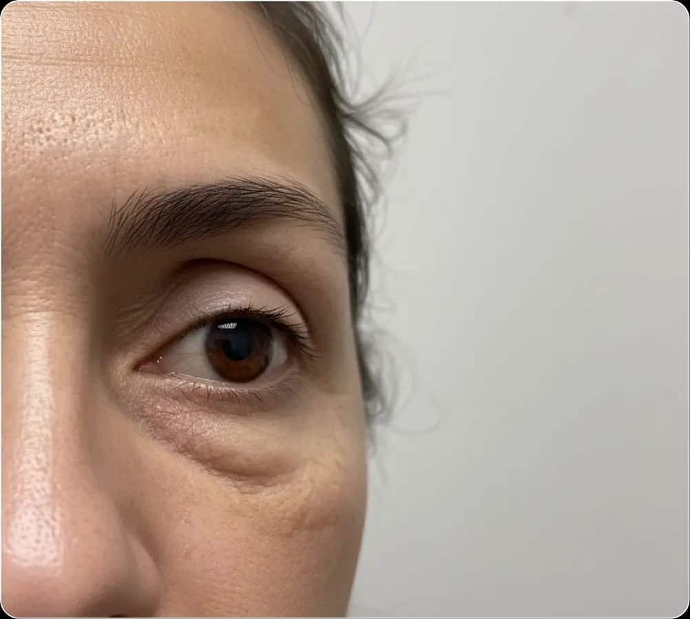 eye bag banner