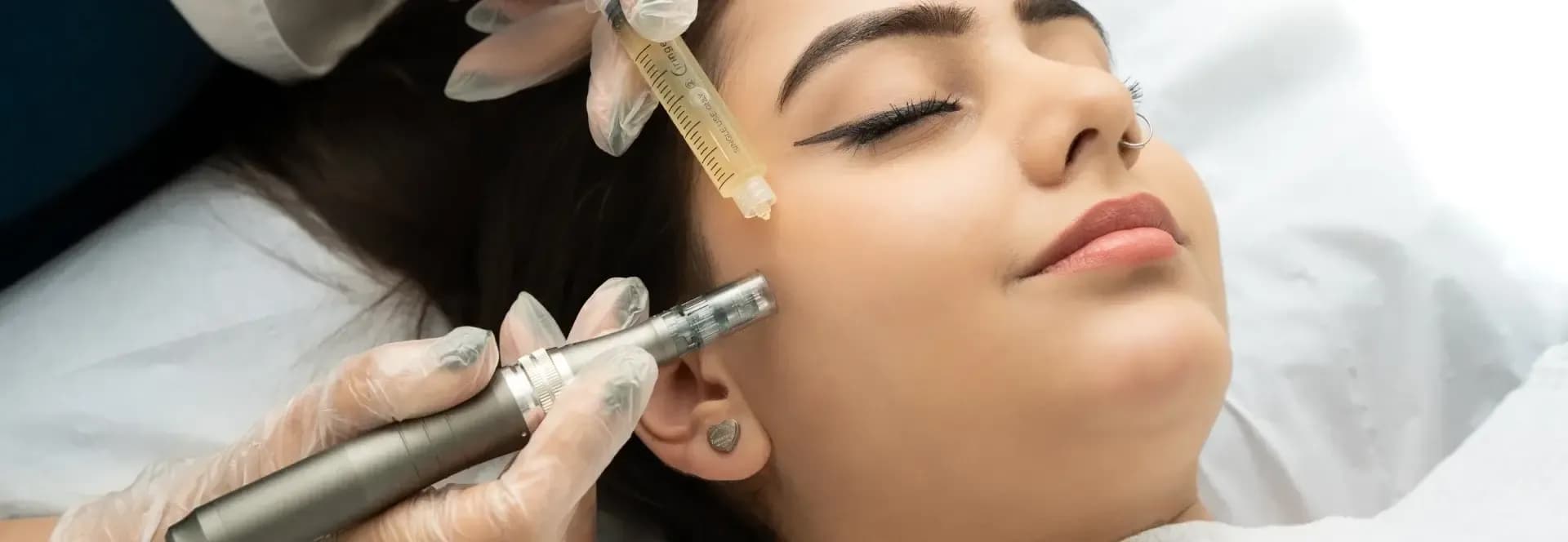 microneedling HERO