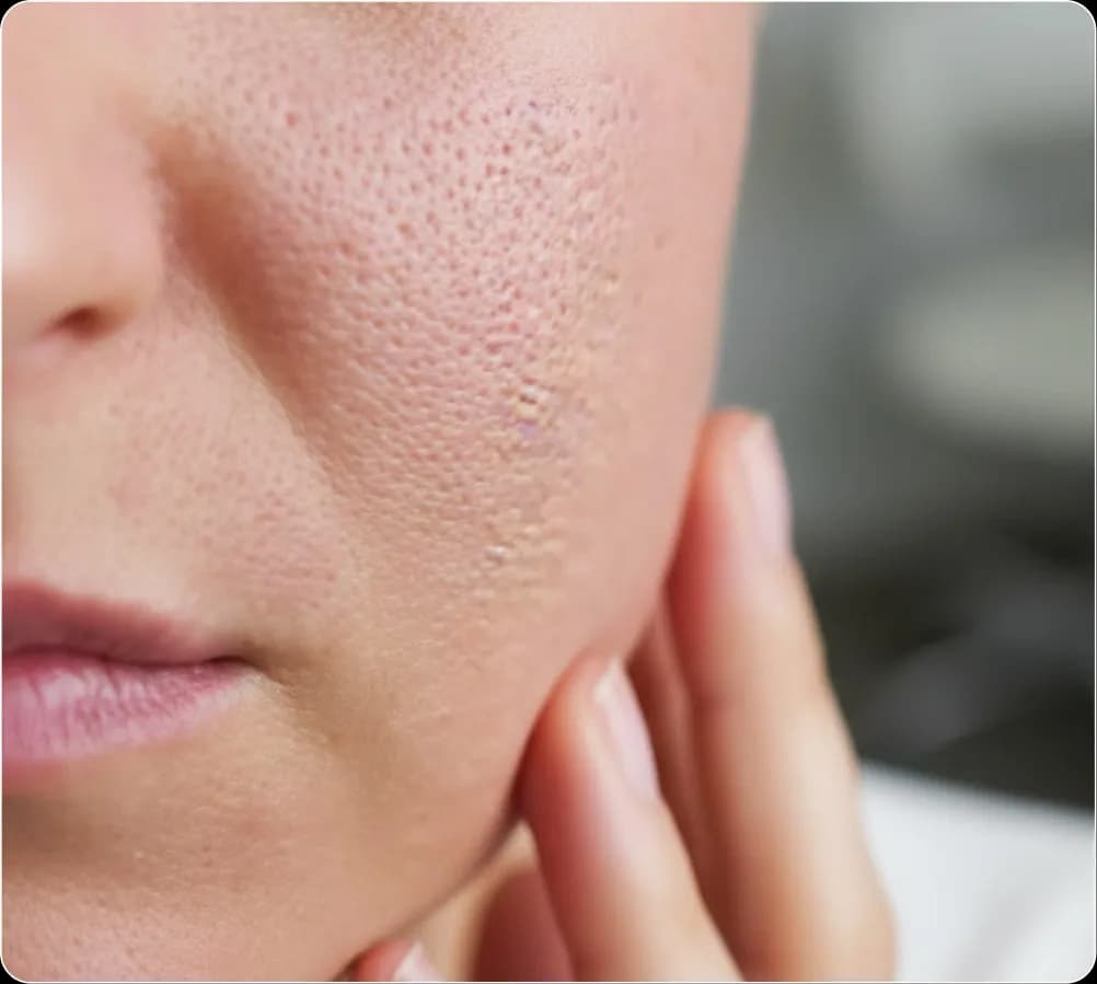 pores banner