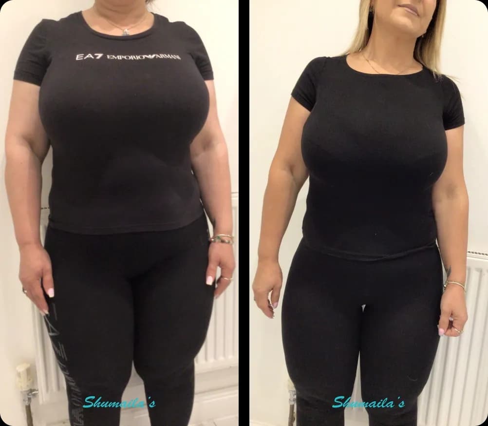 Weight Loss Injections