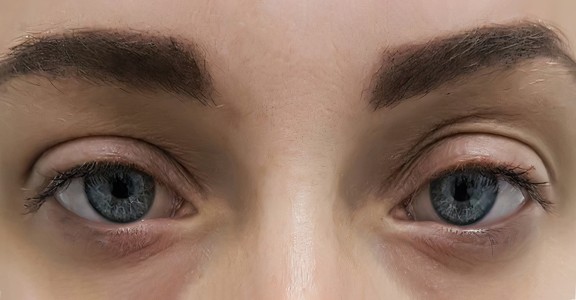 lash lift before