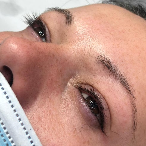 eyelash extensions before