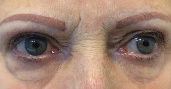 lash lift before