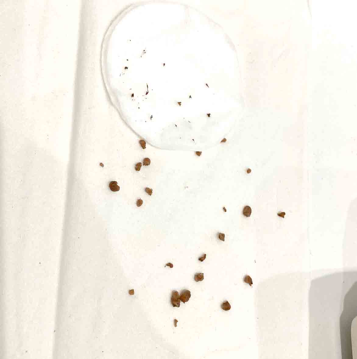 skin tags removed