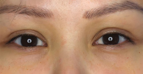 lash lift before