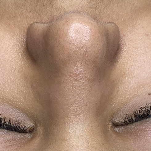 nose