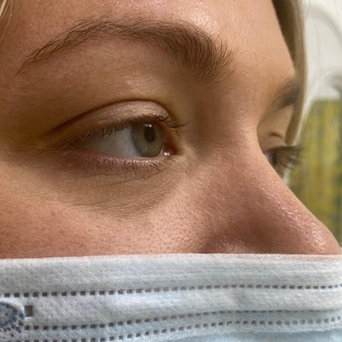 eyelash extensions before