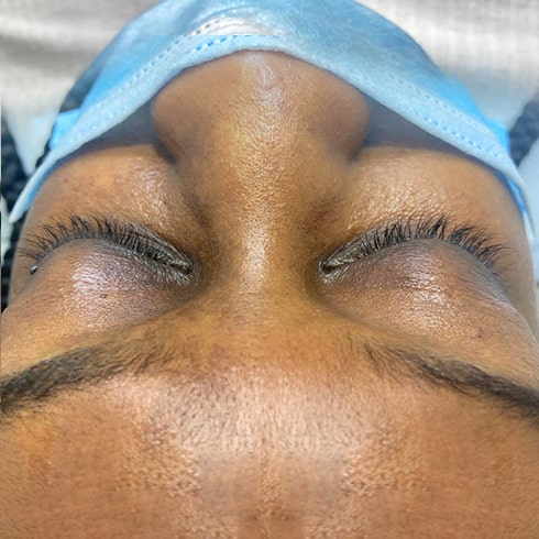 eyelash extensions before