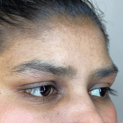 Threading Before