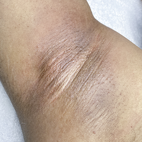 waxed female armpit