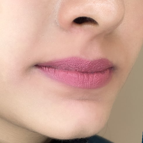 Upperlip After