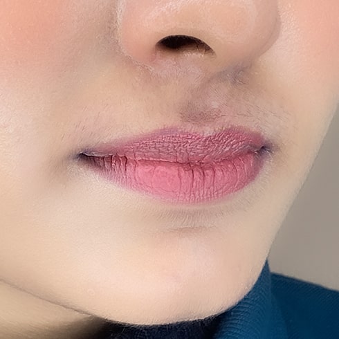 Upperlip Before