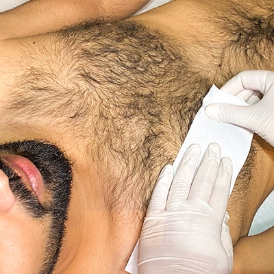 Waxing for men London | Male chest hair being removed by waxing