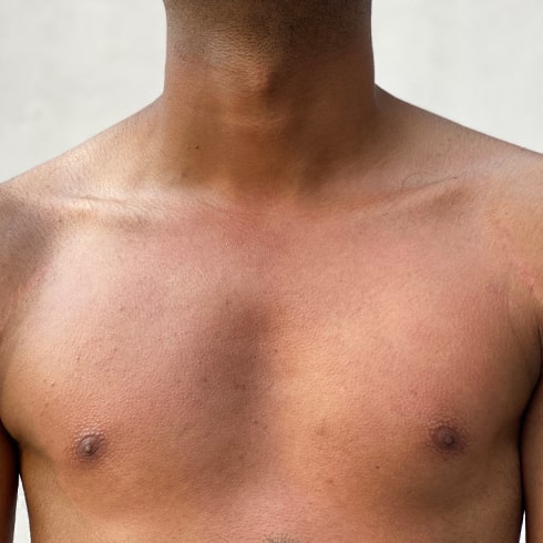 Chest Waxing After