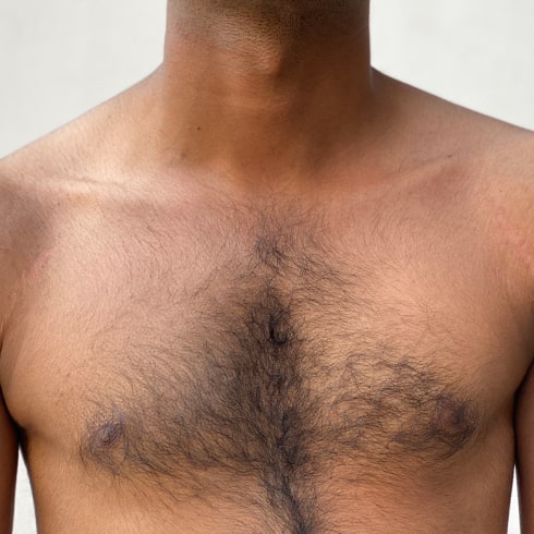 Chest Waxing Before