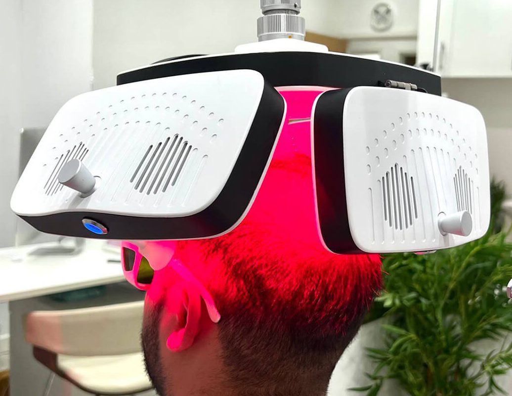 Laser Hair Regrowth