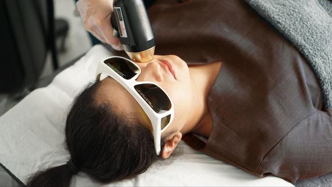 female laid down getting face hair laser removal