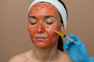 Woman receiving PRP injection during vampire facial treatment
