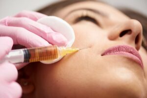 Platelet-rich plasma (PRP) injection into facial skin during vampire facial